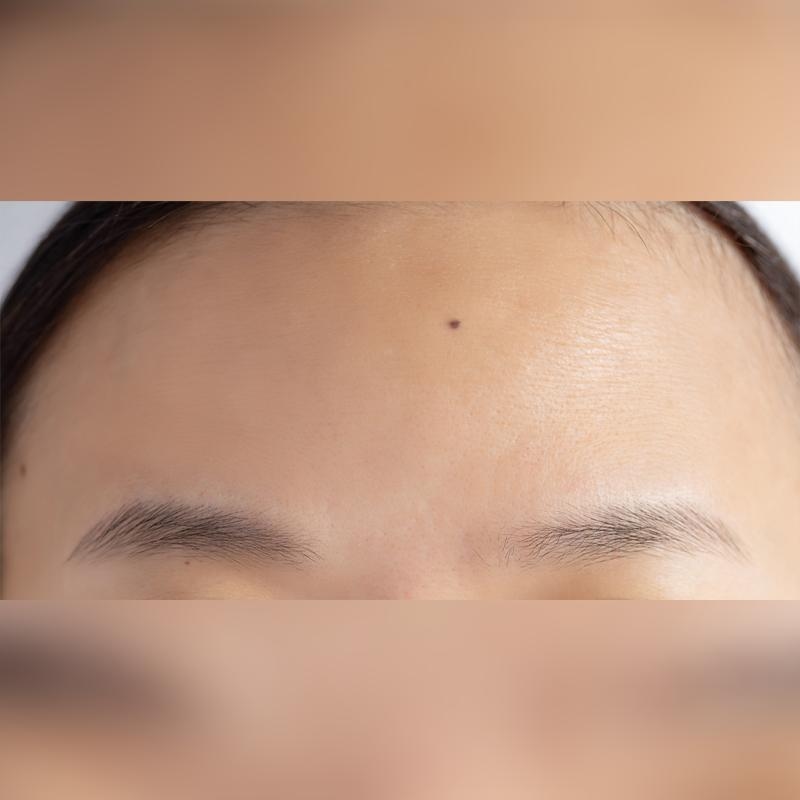 before_image