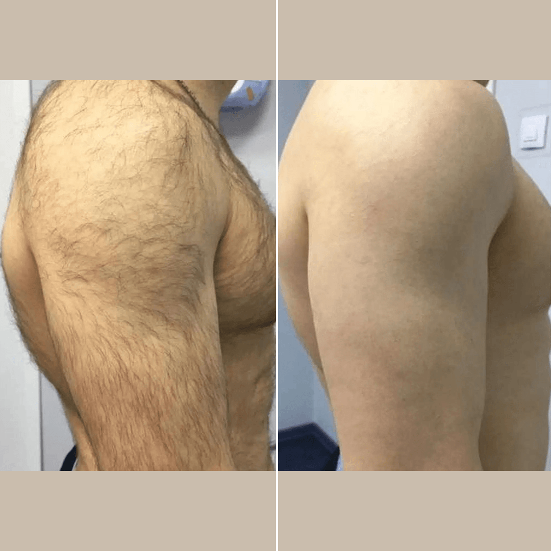 Male-body.png