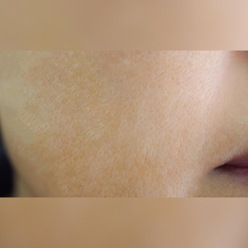 before_image