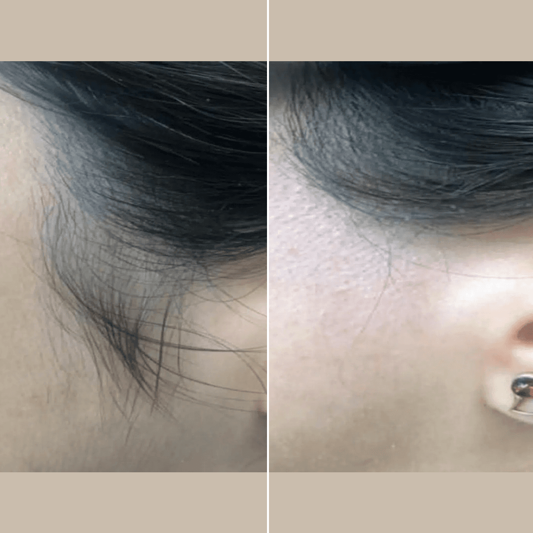 Side-locks (1).png