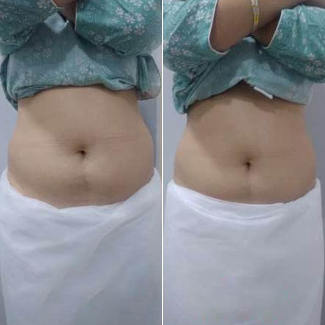 Abdomen.jpg