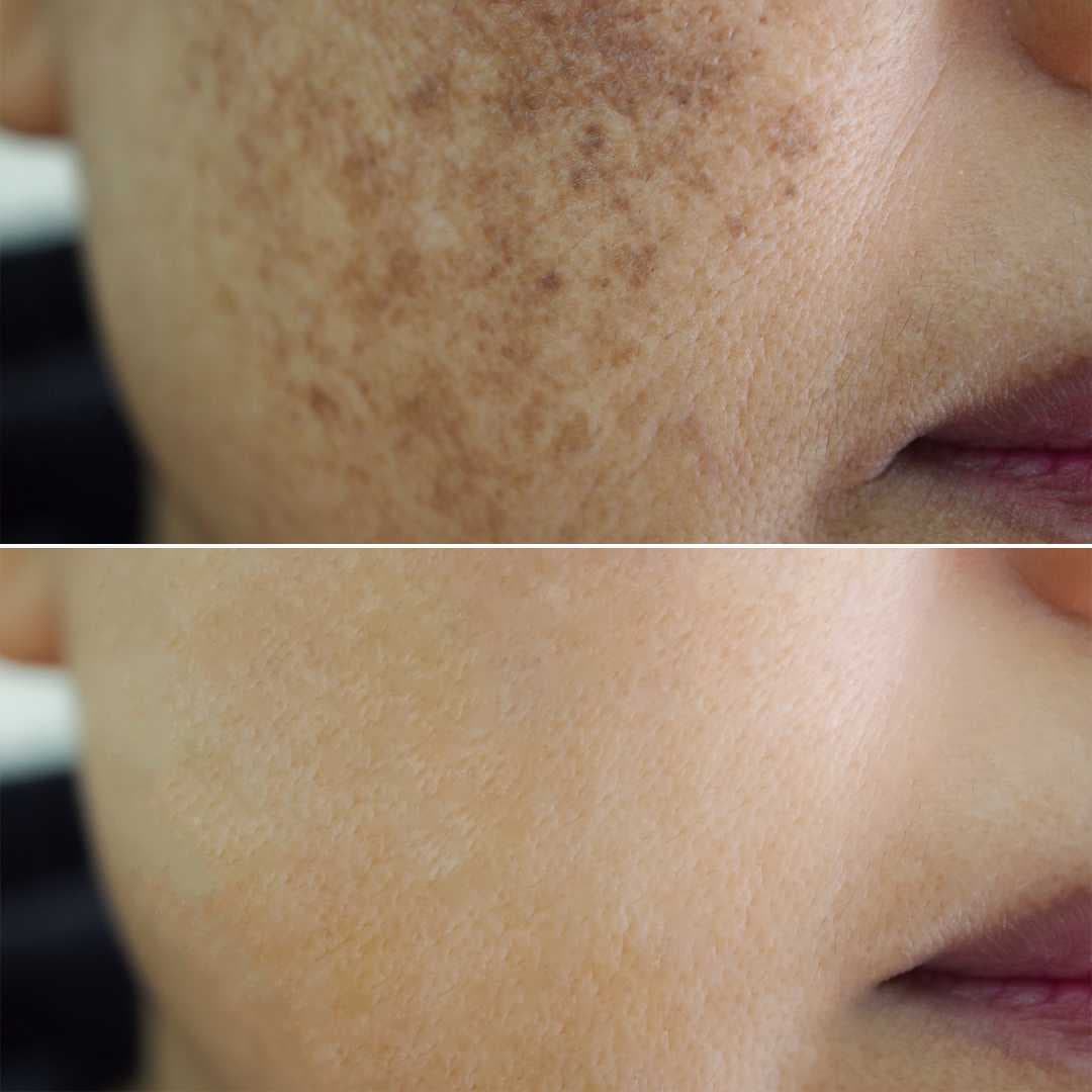 Before-After-High-Res.jpg
