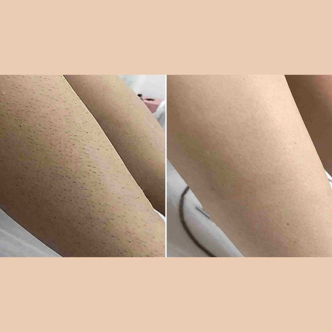 Legs-3.jpg