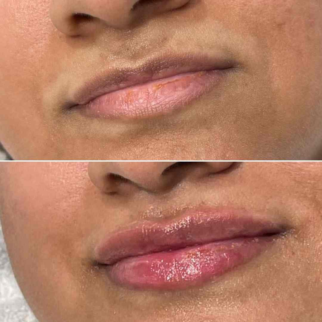 Lip-booster---vital.jpg