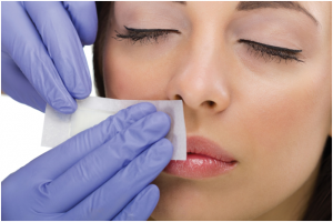 Laser Hair Removal