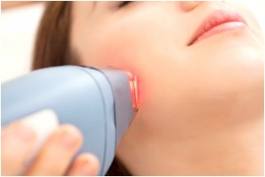Laser Hair Removal In Delhi