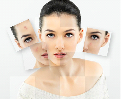 Skin Care, Acne Treatment, Skin Resurfacing