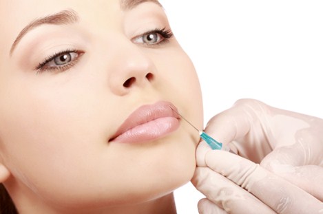 Dermal fillers for acne scars, Dermal fillers side effects, Types of dermal fillers
