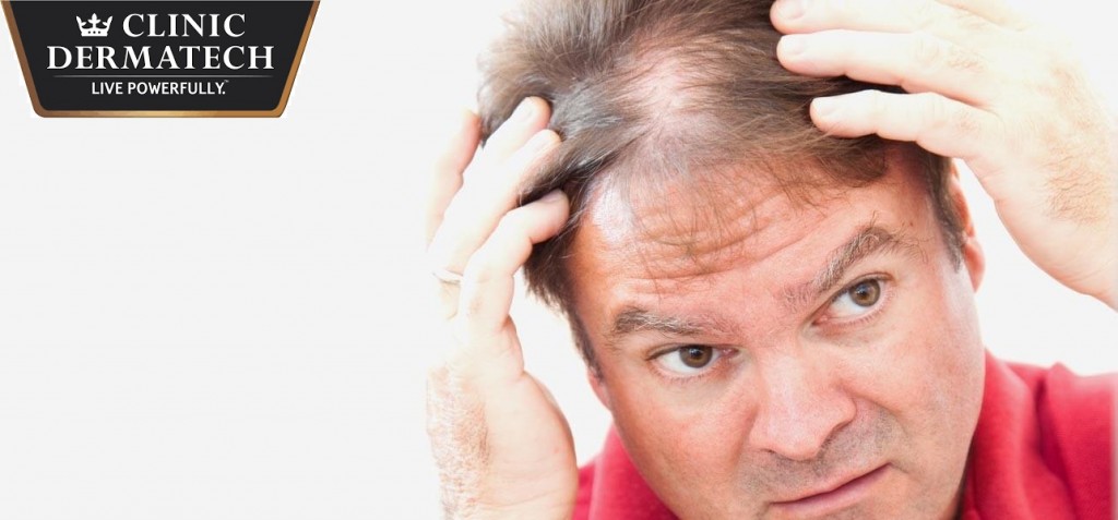 Get Back Lost Hair