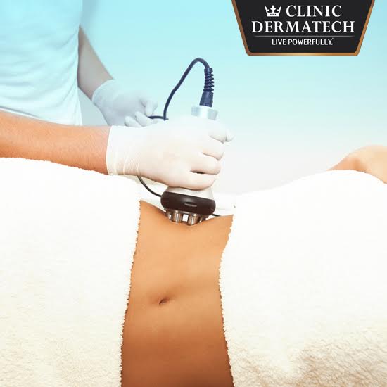 Ultrasonic Cavitation