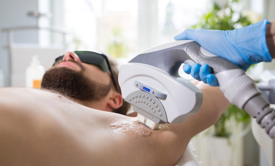 laser treatment for underarm