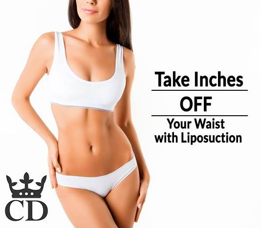 liposuction
