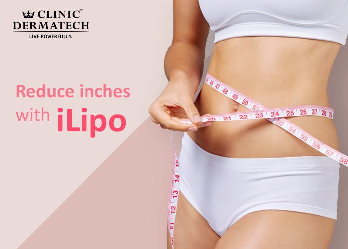 i-lipo laser