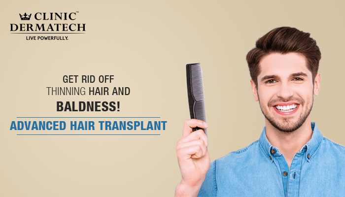 Hair-Transplant