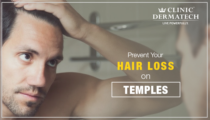 Hair-Transplant