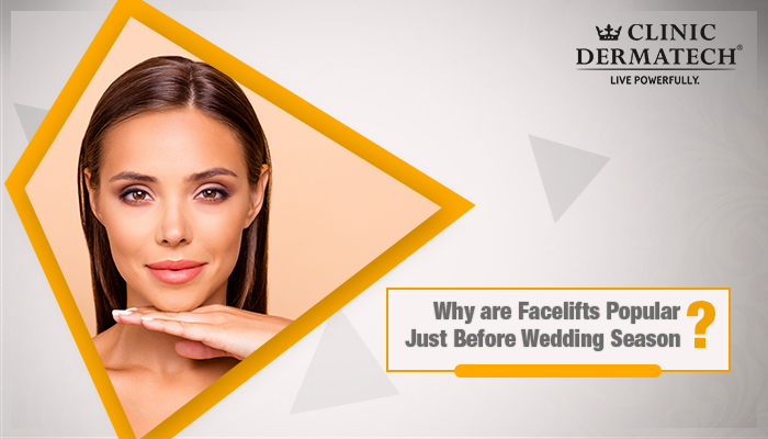Facelift-Surgery-clinic-dermatech