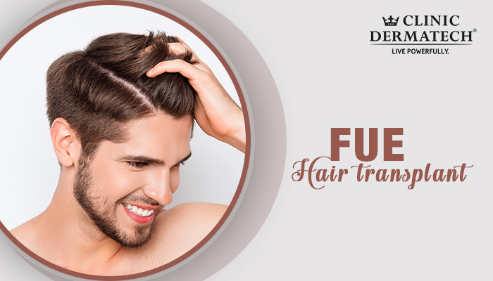FUE Hair Transplant