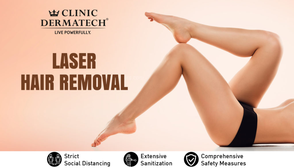 Laser Hair Removal