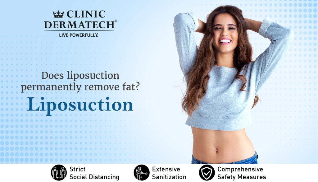 Liposuction