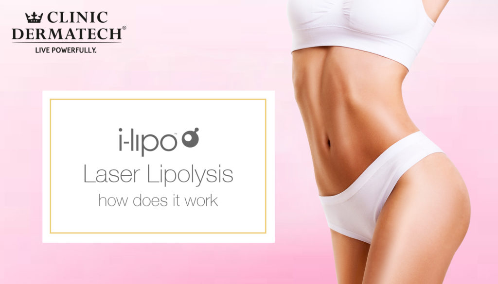 ILipo- Spot fat reduction treatment