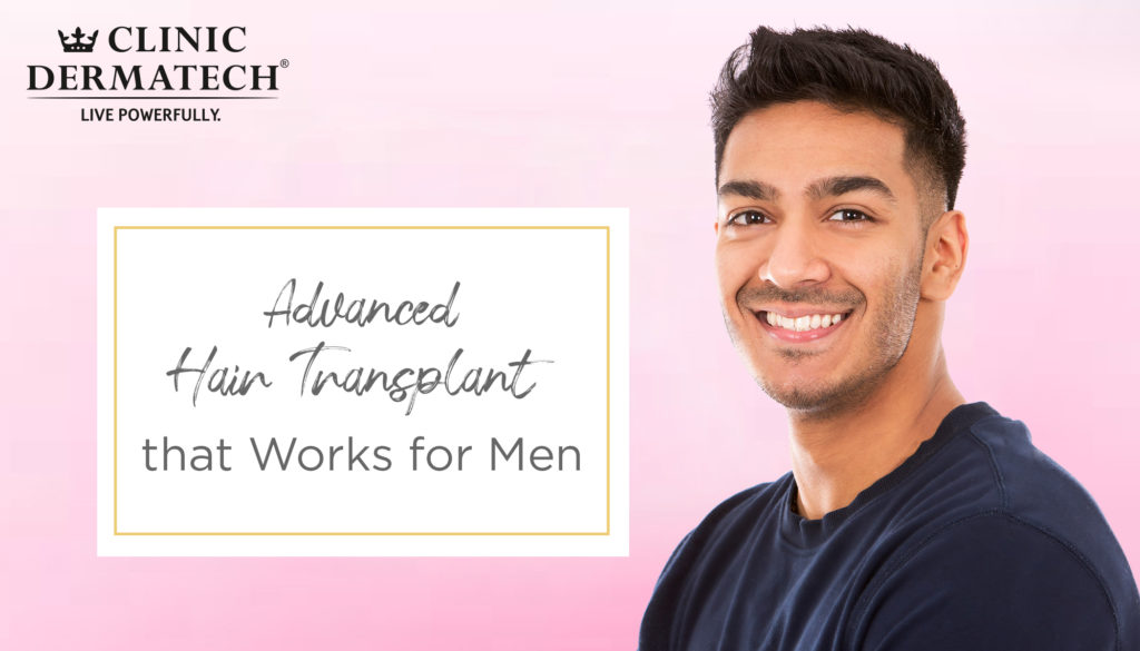 Hair Transplant for Men