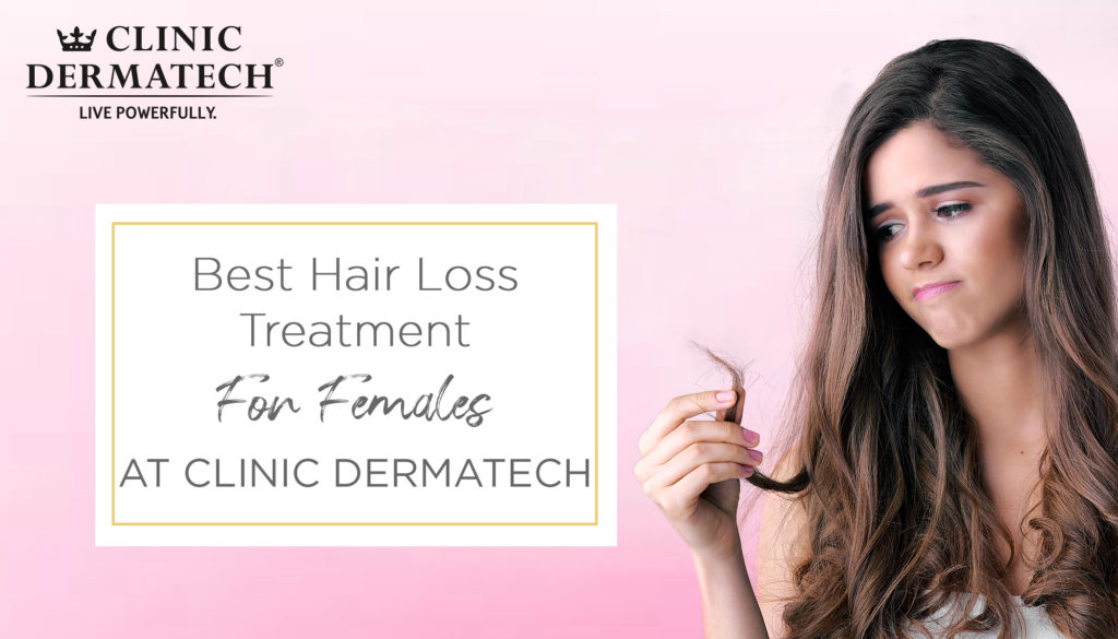Hair loss treatment for female