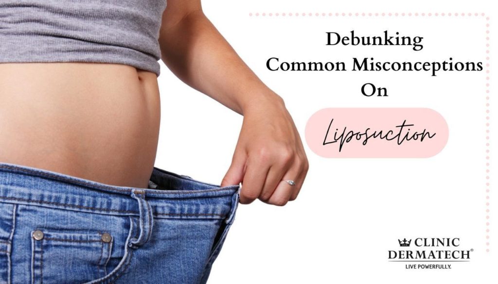 Liposuction