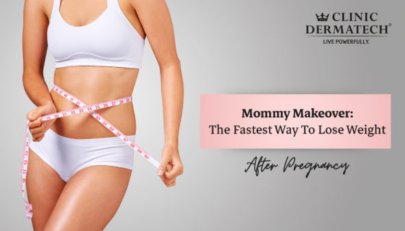 Mommy Makeover: The Fastest Way To Lose Weight After Pregnancy