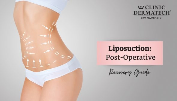 Liposuction: Post-Operative Recovery Guide