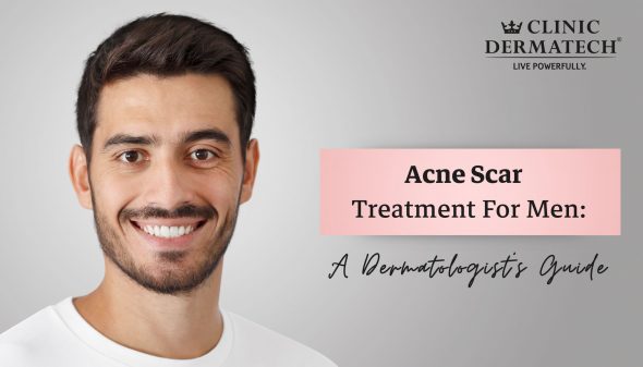 Acne Scar Treatment For Men: A Dermatologist’s Guide
