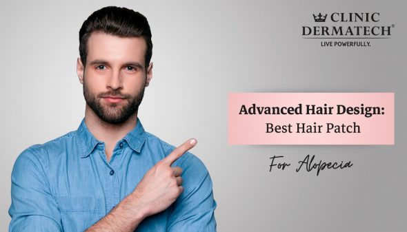 Advanced Hair Design: Best Hair Patch For Alopecia