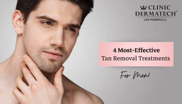 4 Effective Tan Removal Treatments For Men