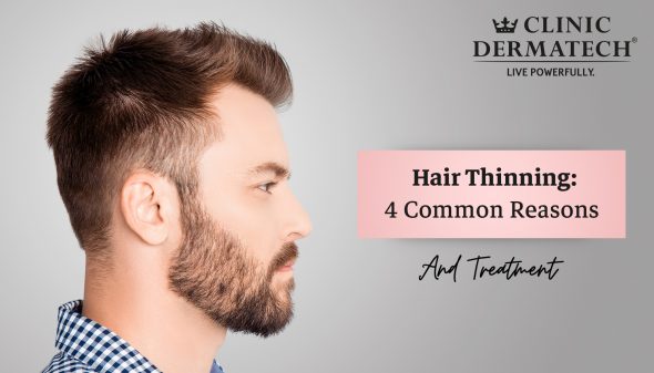 Hair Thinning: 4 Common Reasons and Treatment