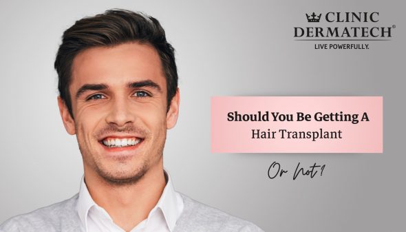 Should You Be Getting A Hair Transplant Or Not?