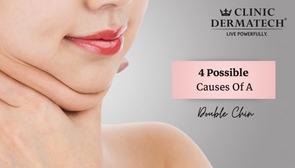 4 Possible Causes Of A Double Chin