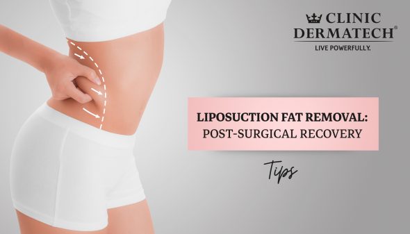 Liposuction Fat Removal: Post-Surgical Recovery Tips