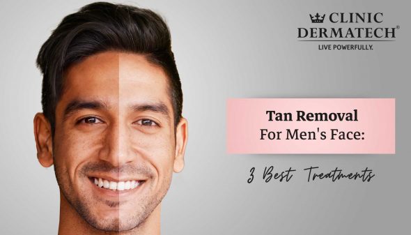 Tan Removal For Men’s Face: 3 Best Treatments