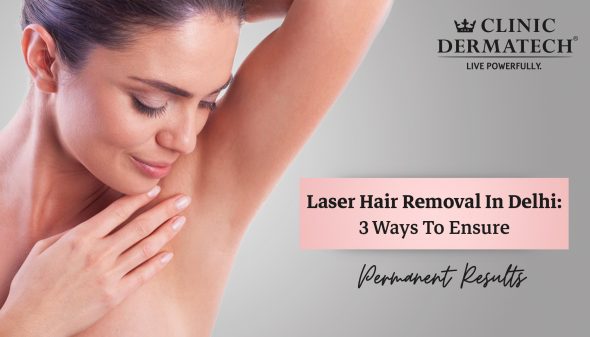 Laser Hair Removal In Delhi: 3 Ways To Ensure Permanent Results