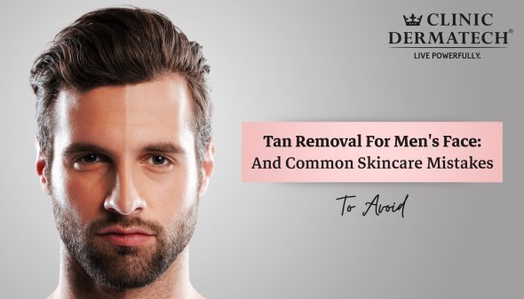 Tan Removal For Men’s Face: And Common Skincare Mistakes To Avoid