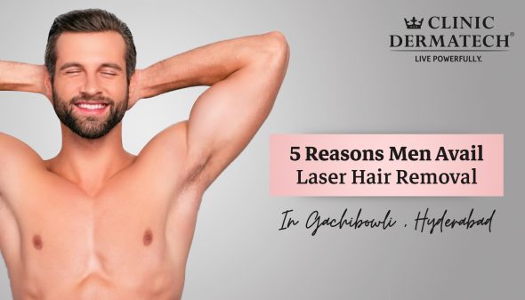 5 Reasons Men Avail Laser Hair Removal In Gachibowli, Hyderabad