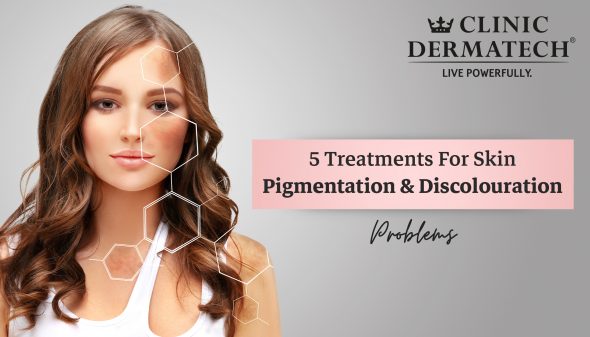 5 Treatments For Skin Pigmentation & Discolouration Problems