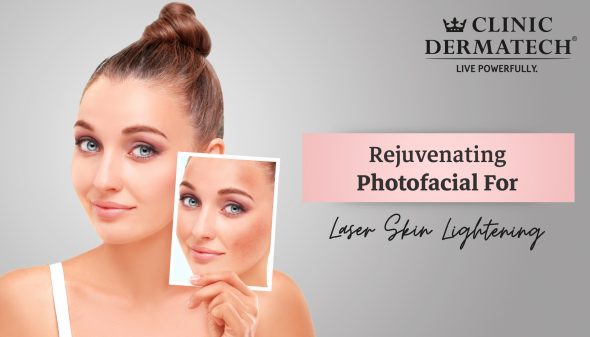 Rejuvenating Photofacial For Laser Skin Lightening