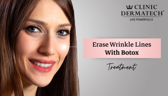 Erase Wrinkle Lines With Botox Treatment