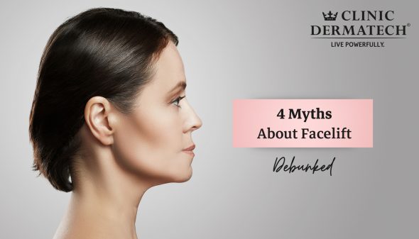 4 Myths About Facelift Debunked!