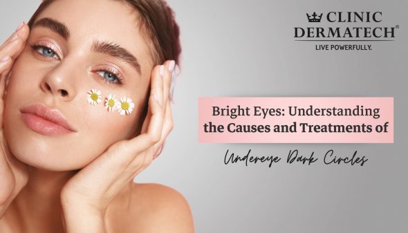 Bright Eyes: Understanding the Causes and Treatments of Undereye Dark Circles