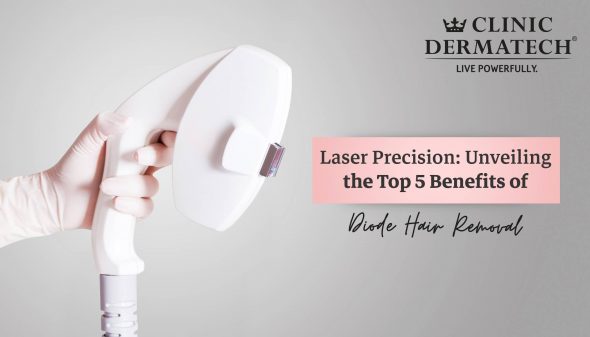 Laser Precision: Unveiling the Top 5 Benefits of Diode Hair Removal