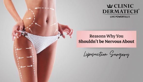 Reasons Why You Shouldn’t be Nervous About Liposuction Surgery