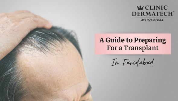 A Guide to Preparing for a Hair Transplant in Faridabad