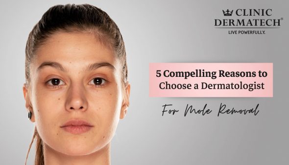 5 Compelling Reasons to Choose a Dermatologist for Mole Removal