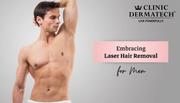 Embracing Laser Hair Removal for Men